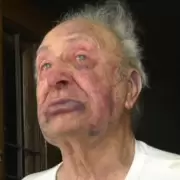 Jubilado de 88 a�os fue brutalmente golpeado en un asalto: "Ten�a miedo de que me mataran"