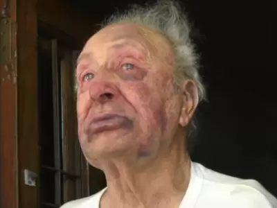 Jubilado brutalmente golpeado para robarle