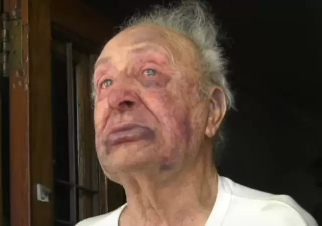 Jubilado brutalmente golpeado para robarle