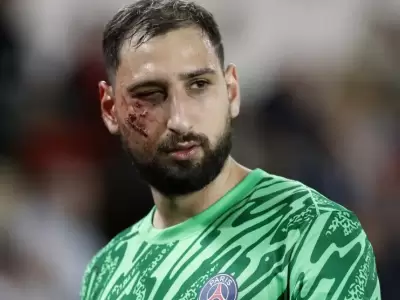 As� qued� el rostro del italiano