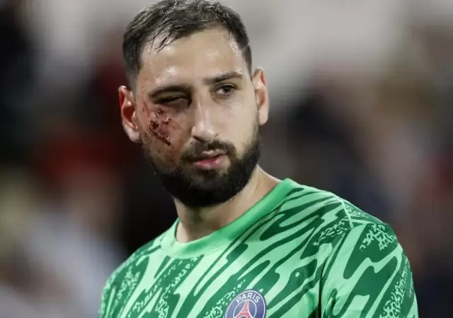 As� qued� el rostro del italiano