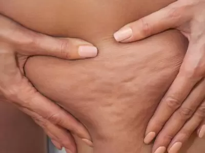 Hay alimentos que ayudan a que se retenga l�quido en el organismo./