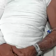 Su hermano le prendi� fuego tras discutir por un sachet de mayonesa