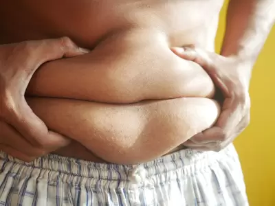 Obesidad/