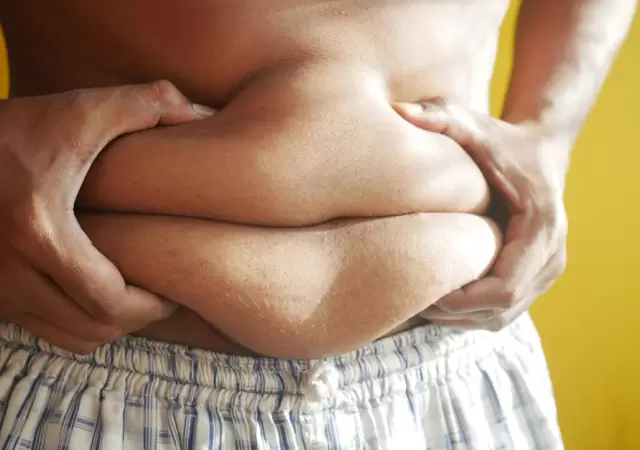 Obesidad/