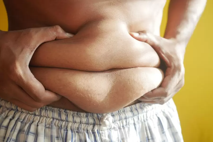Obesidad/