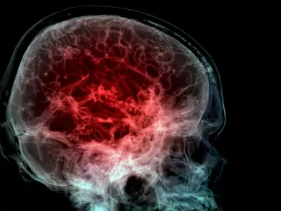 Un estudio descubri� niveles alarmantes de micropl�sticos en el cerebro.