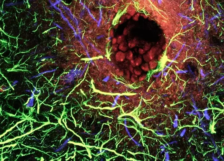 Esta imagen muestra una ruptura de la barrera hematoencef�lica. Se ha inyectado un trazador fluorescente (rojo) en la sangre.