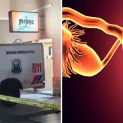Muerte de la joven en un motel sanjuanino: qué es un shock neurogénico