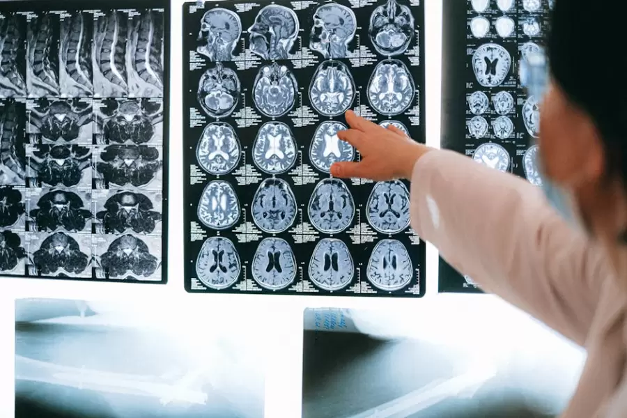 Fotos de stock gratuitas de abrigo blanco, anatomía, cerebro