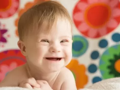 Aunque las personas con s�ndrome de Down pueden tener complicaciones, la salud de muchos de estos ni�os no tiene por qu� ser distinta a la del resto.