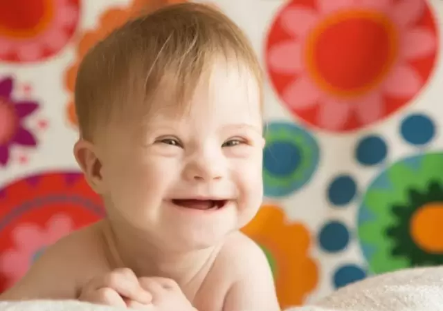 Aunque las personas con s�ndrome de Down pueden tener complicaciones, la salud de muchos de estos ni�os no tiene por qu� ser distinta a la del resto.