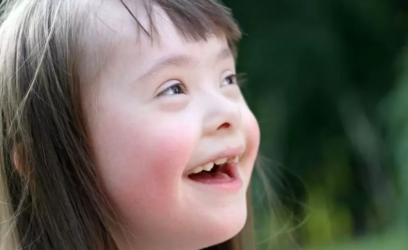 Cada persona que nace con s�ndrome de Down es diferente. Algunos tienen problemas de salud.