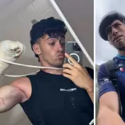 �Qui�n es Gero Arias, el influencer perdi� dos dedos tras sufrir un grave accidente?
