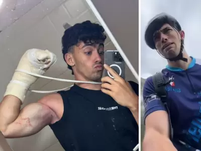 El influencer sufri� un accidente mientras sub�a un cerro junto a su padre.