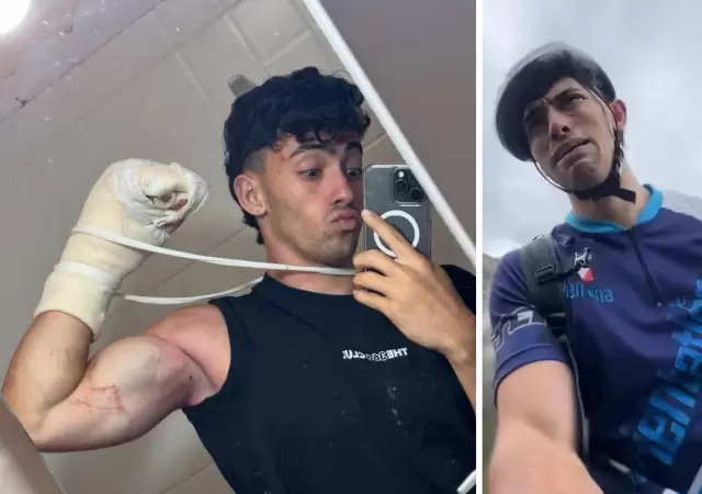 El influencer sufri� un accidente mientras sub�a un cerro junto a su padre.