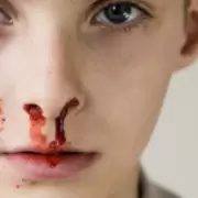 Si tenés hemofilia, el sistema tiene la obligación de atenderte