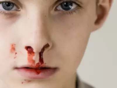 Los tratamientos para la hemofilia pueden ayudar a controlar la enfermedad, aunque no existe cura conocida.