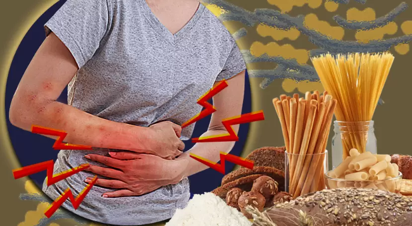 La celiaqu�a es una patolog�a cr�nica y autoinmune y el origen es la intolerancia permanente al gluten