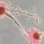 Hongo mortal se expande por el mundo y el cambio clim�tico podr�a desatar una pandemia silenciosa
