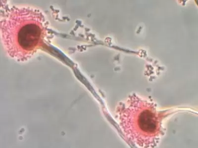 El Aspergillus.