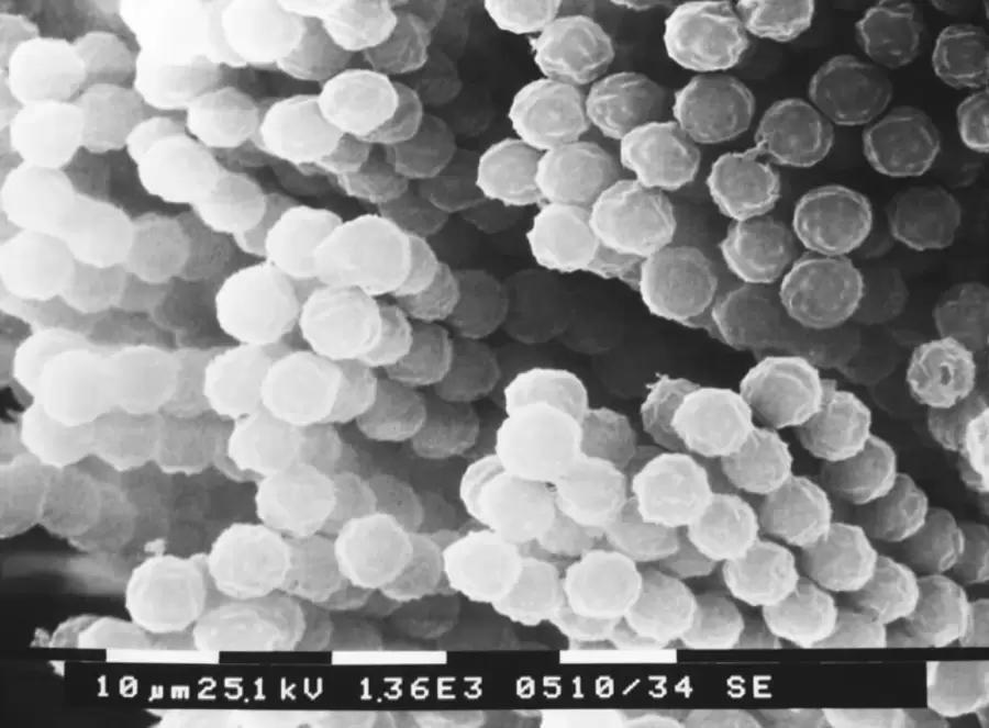 Cadenas de esporas de Aspergillus.