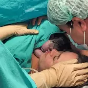 Nació la primera bebé operada dentro del útero de su madre en el Garrahan