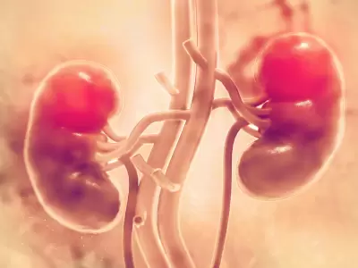 C�ncer renal: s�ntomas, factores de riesgo y c�mo prevenir la enfermedad.