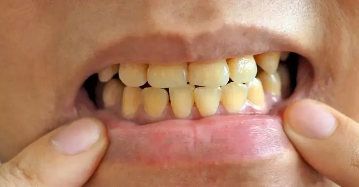 No se trata de una cuestión estética: la salud del organismo comienza en la boca.