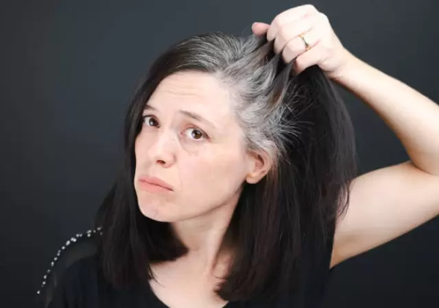 Evit� las canas.
