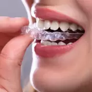 Las claves para cuidar la dentadura y mantenerla libre de bacterias