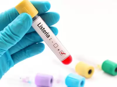 Alerta nacional: brote de listeriosis mortal por queso contaminado