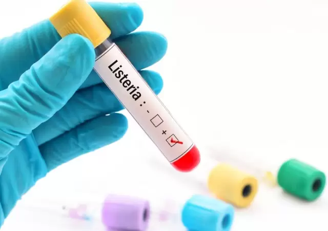 Alerta nacional: brote de listeriosis mortal por queso contaminado