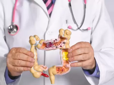 C�ncer colorrectal