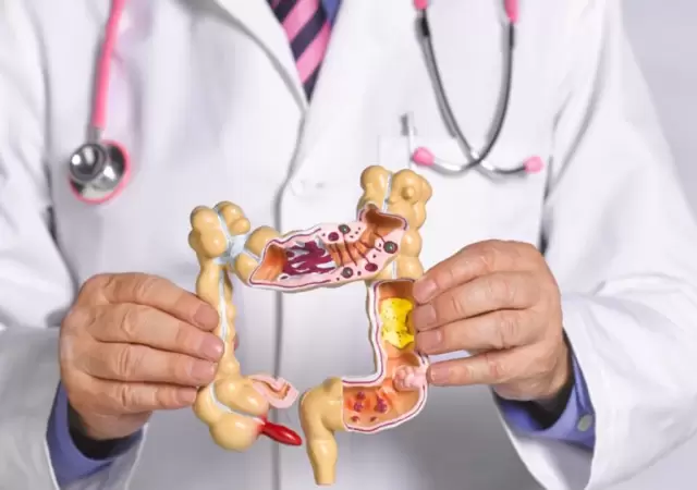 C�ncer colorrectal