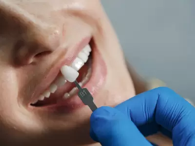Est�tica dental: consejos de una especialista tras la muerte en una cl�nica porte�a.