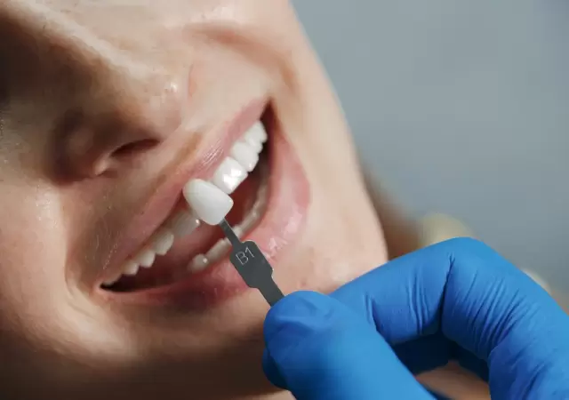 Est�tica dental: consejos de una especialista tras la muerte en una cl�nica porte�a.