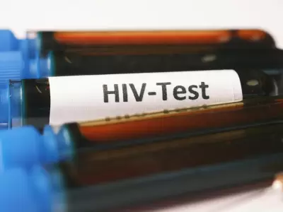 Todos los test de VIH son gratuitos, an�nimos y se recomienda hacerlo cada a�o.