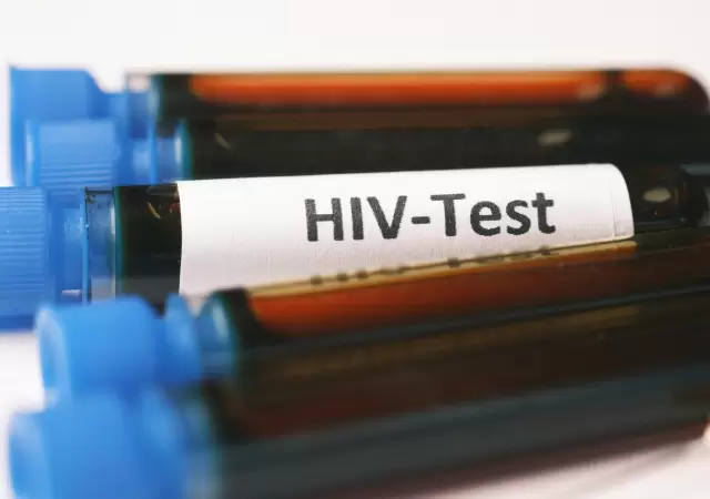 Todos los test de VIH son gratuitos, an�nimos y se recomienda hacerlo cada a�o.