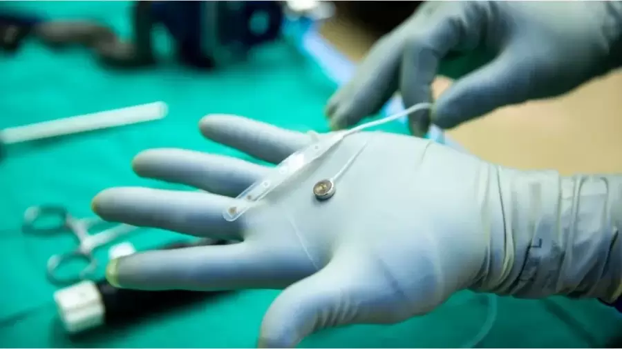 El dispositivo de Paradromcis es m�s peque�o que una moneda. Foto: web