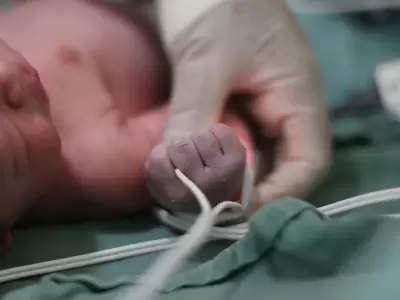 Las tres hermanitas est�n en incubadora