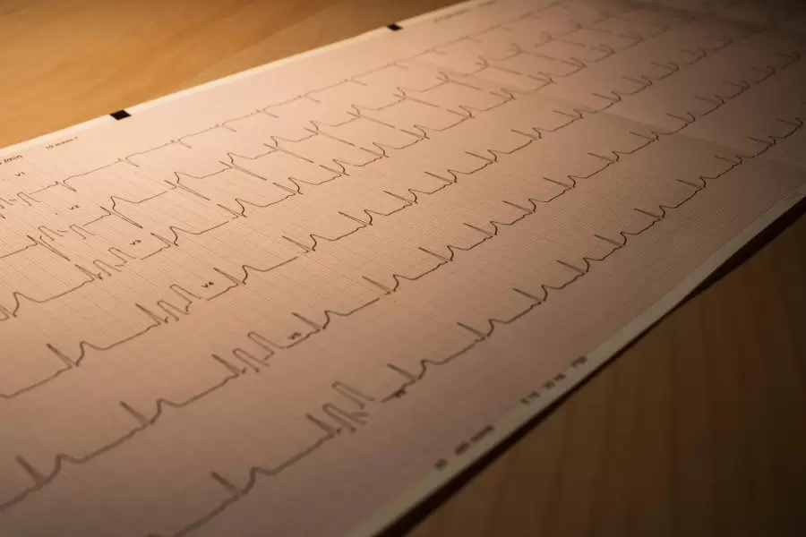 El cardi�logo record� la importancia de realizarse 3 estudios: electrocardiograma, ecocardiograma y ergometr�a