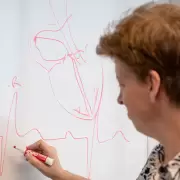 Revolución en cardiología: el marcapasos argentino que imita la vida misma