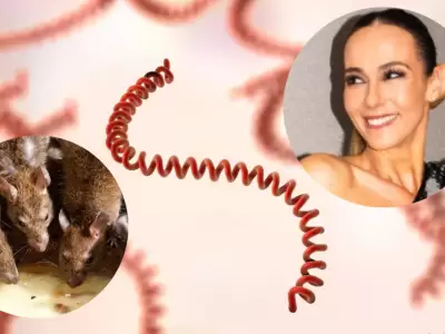 A diferencia de otros pat�genos, la bacteria de la leptospirosis tiene una forma particular: un espiral o resorte.