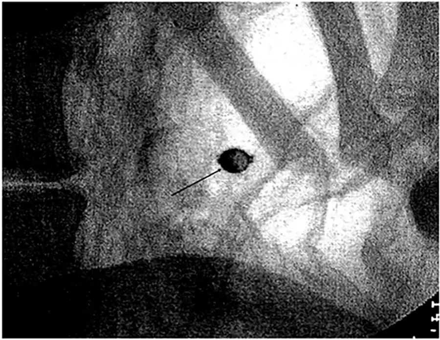 Ni milagro ni veneno: la ciencia descifr� el enigma de la momia de la cripta.