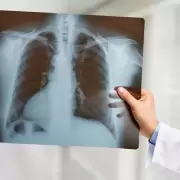 El hombre que vivió 48 horas sin pulmones: ¿el fin de las listas de espera?