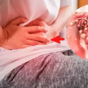 El c�ncer de colon y una advertencia clave: el estudio sencillo que puede salvarte la vida