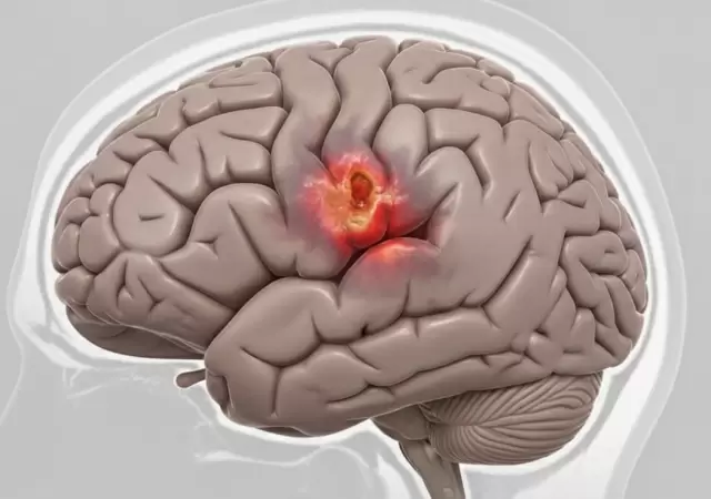 Identificar se�ales para prevenir da�os permanentes.