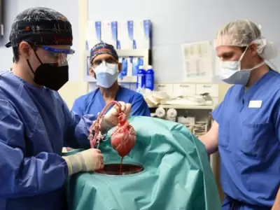 trasplant� de organo