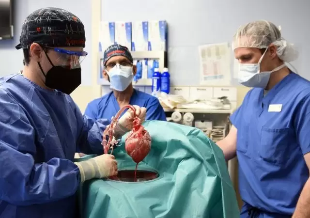 trasplant� de organo